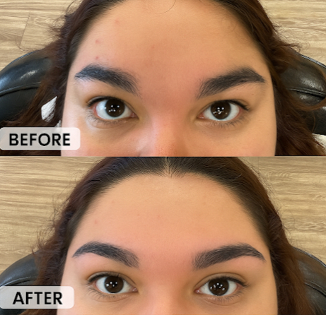 Eyebrow Threading Before and After Comparison Eyebrow Threading Before and After